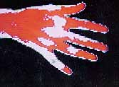 THERMOGRAPHY OF THE HAND