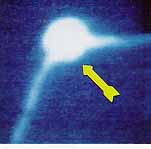 ELECTRICAL ARC